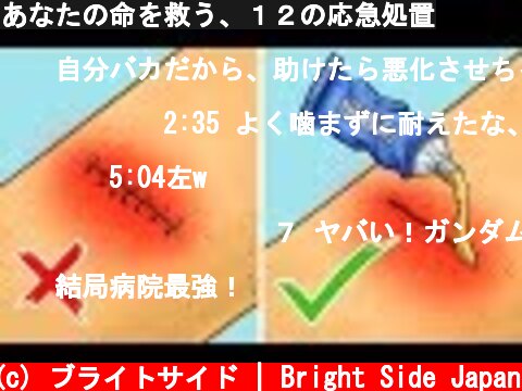 あなたの命を救う、１２の応急処置  (c) ブライトサイド | Bright Side Japan