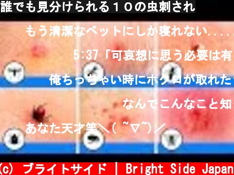 誰でも見分けられる１０の虫刺され  (c) ブライトサイド | Bright Side Japan