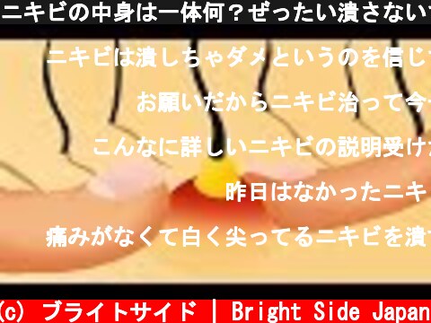 ニキビの中身は一体何？ぜったい潰さないで！  (c) ブライトサイド | Bright Side Japan
